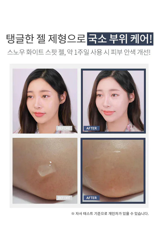 Secret Key Snow White Spot Gel