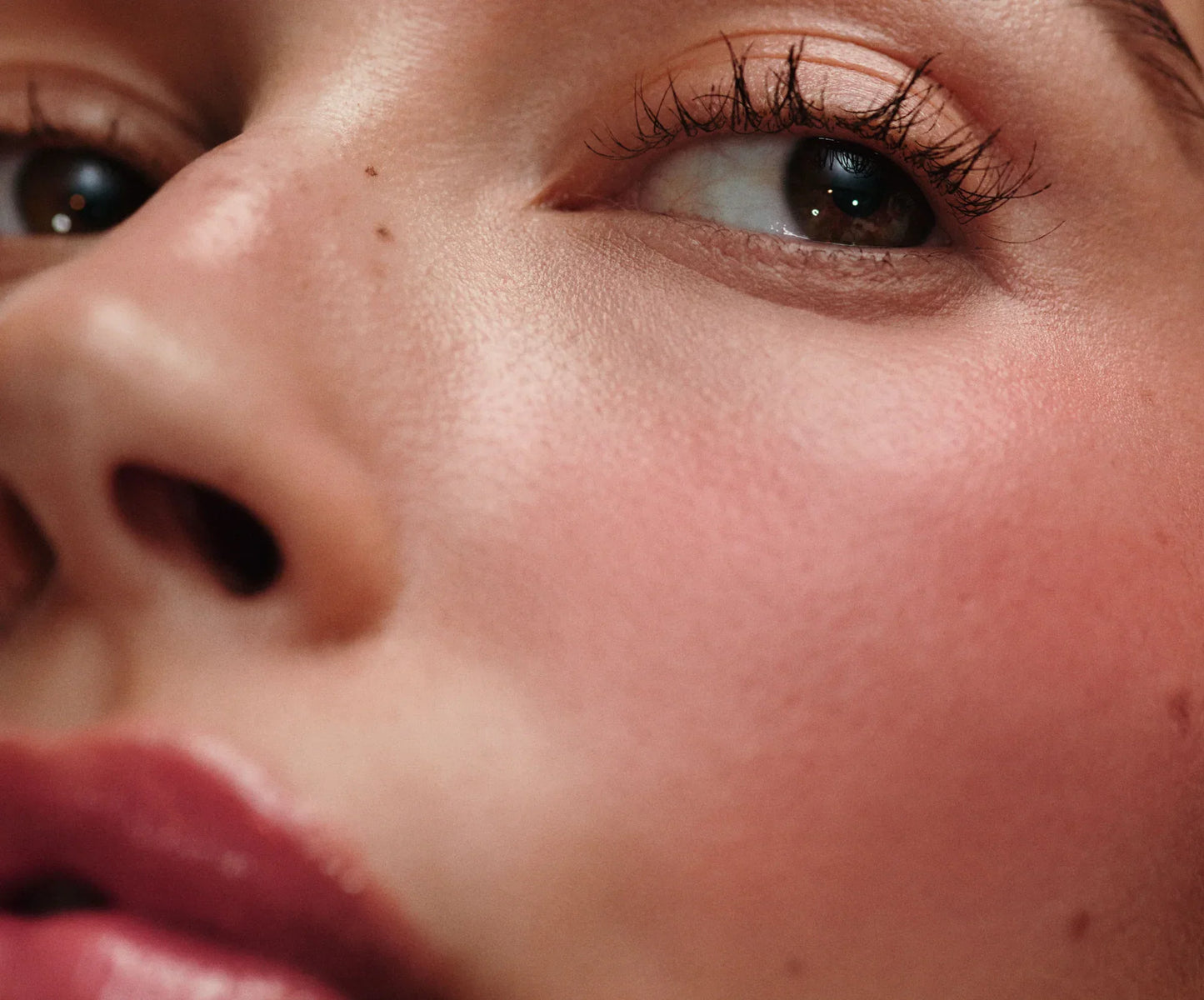 #variant_freckle