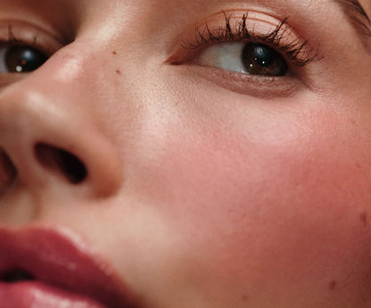#variant_freckle