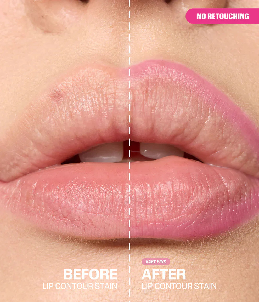 #variant_baby-pink