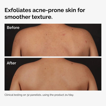The Ordinary Body Care Collection